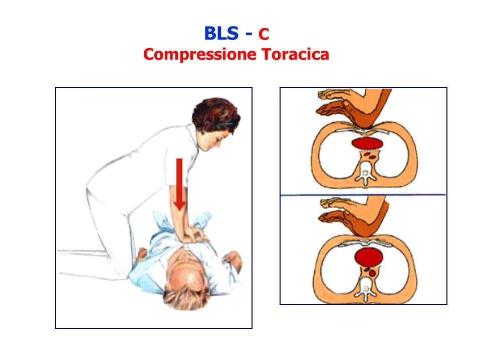 BLS - C Compressione Toracica