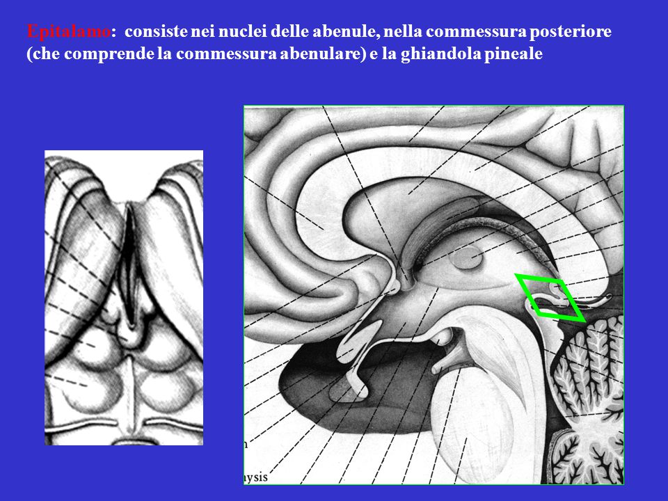 Epitalamo: consiste nei nuclei delle abenule, nella commessura posteriore (che comprende la commessura abenulare) e la ghiandola pineale