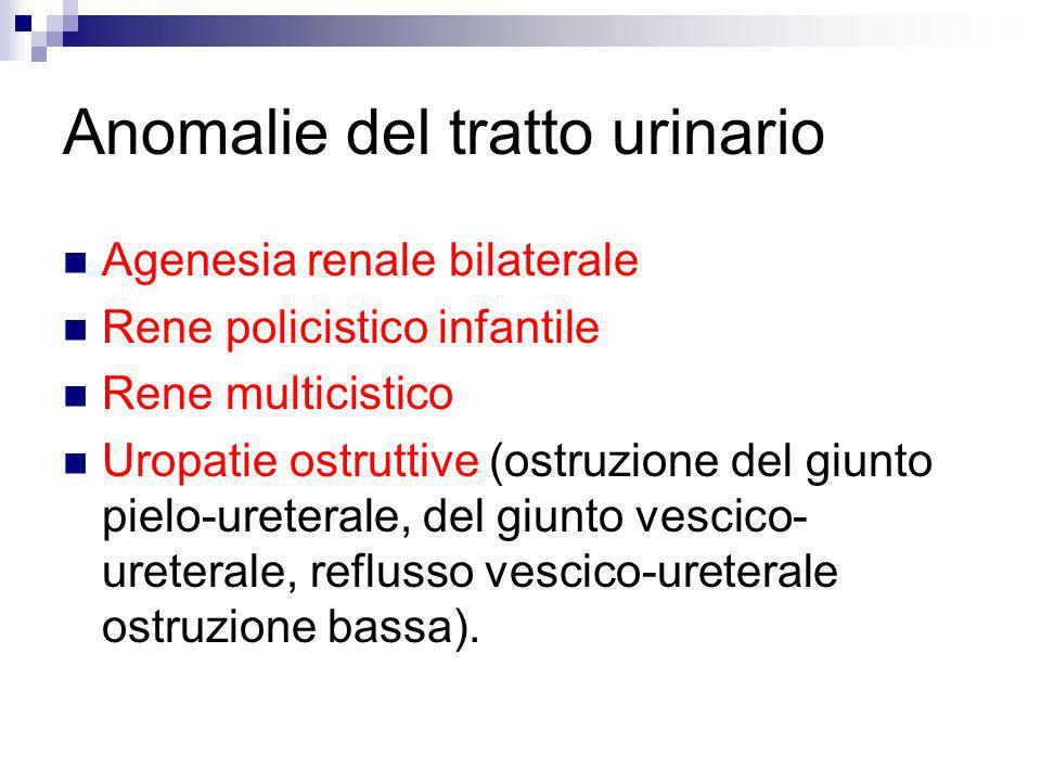 Anomalie del tratto urinario