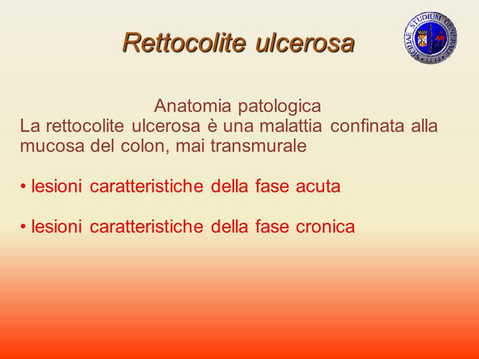 Rettocolite ulcerosa Anatomia patologica