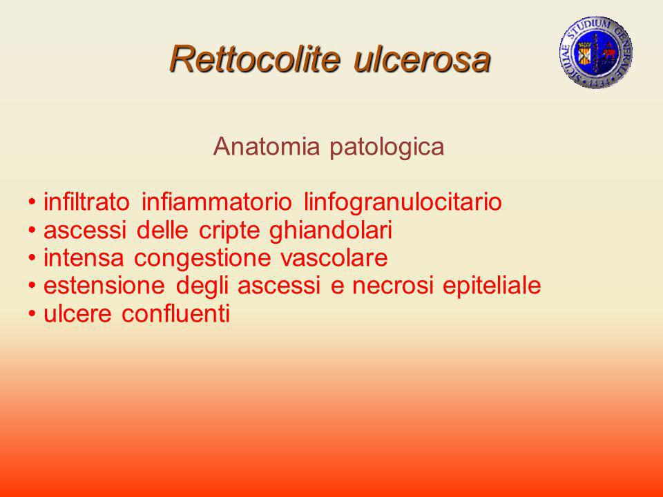 Rettocolite ulcerosa Anatomia patologica