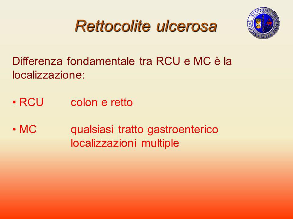 Rettocolite ulcerosa Differenza fondamentale tra RCU e MC è la localizzazione: RCU colon e retto. MC qualsiasi tratto gastroenterico.