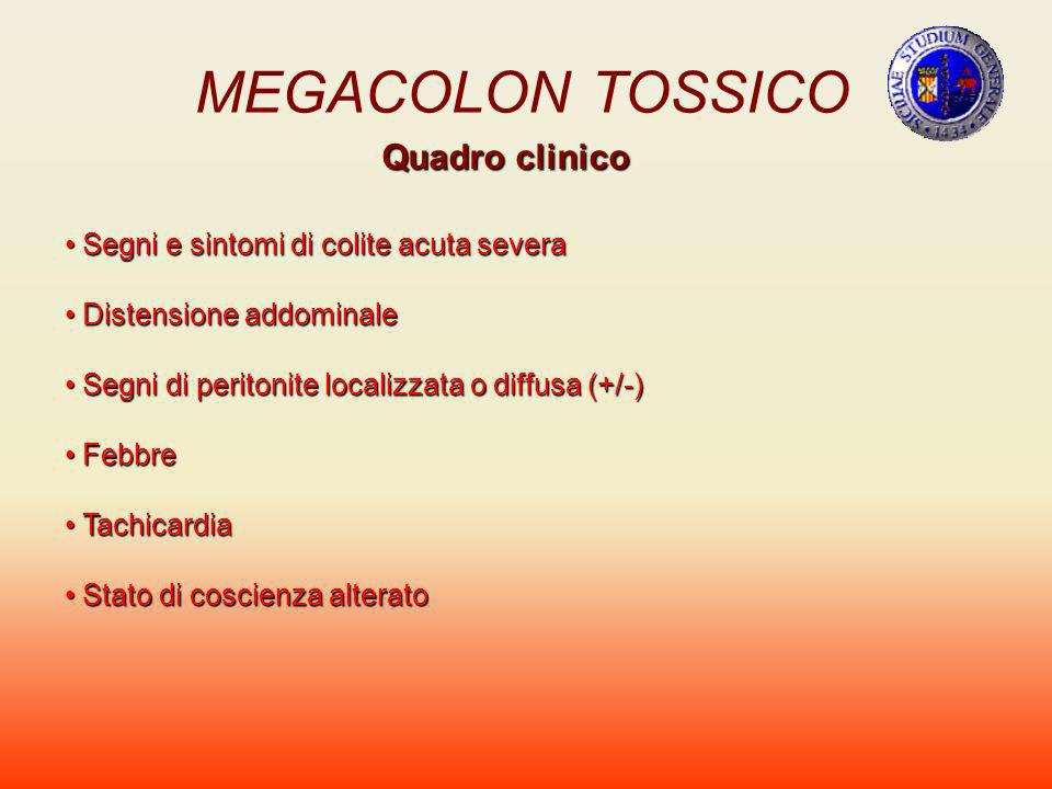 MEGACOLON TOSSICO Quadro clinico