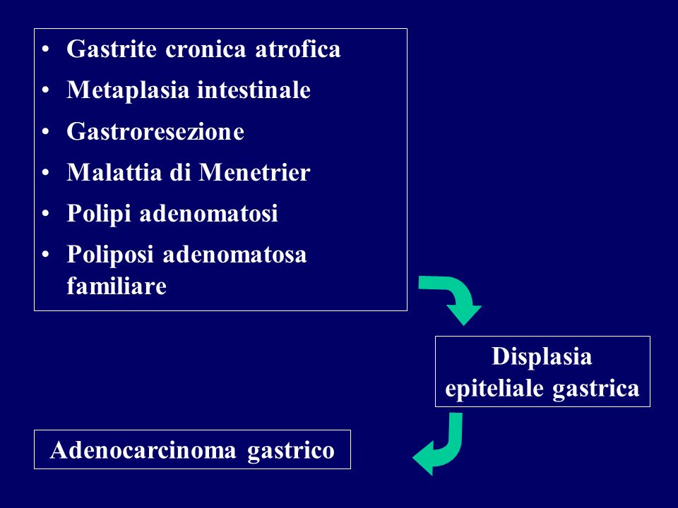 Displasia epiteliale gastrica Adenocarcinoma gastrico