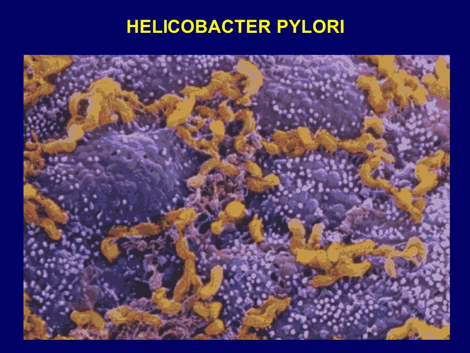 Как выглядит хеликобактер пилори под микроскопом фото