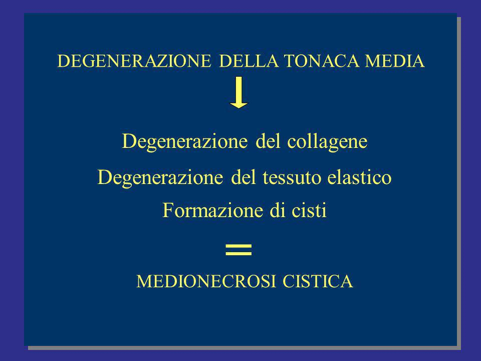= Degenerazione del collagene Degenerazione del tessuto elastico