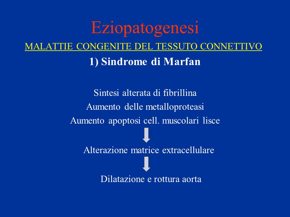 Eziopatogenesi 1) Sindrome di Marfan