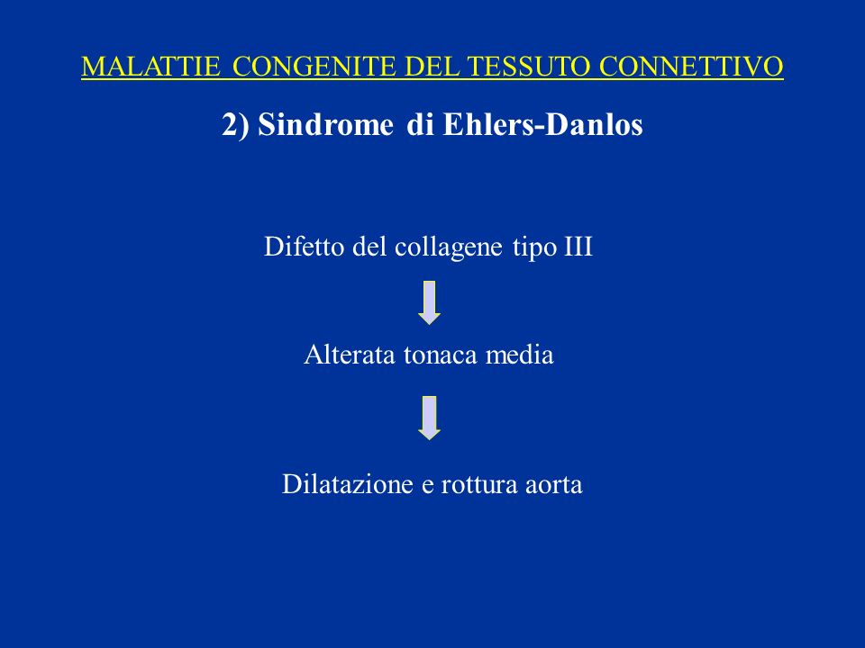 2) Sindrome di Ehlers-Danlos
