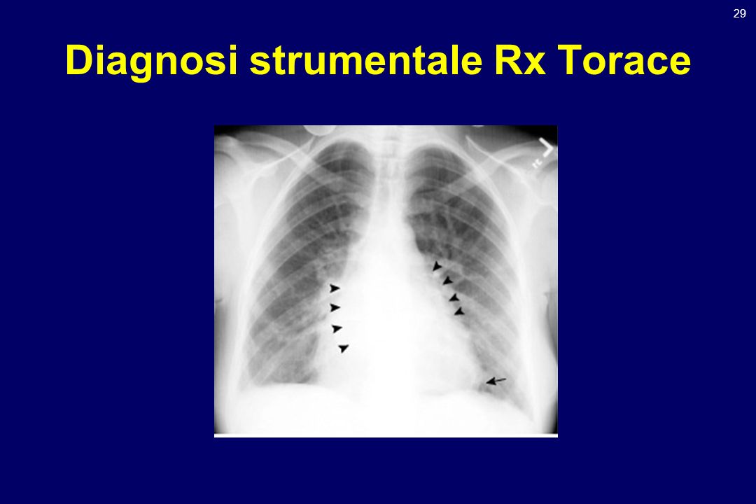 Diagnosi strumentale Rx Torace