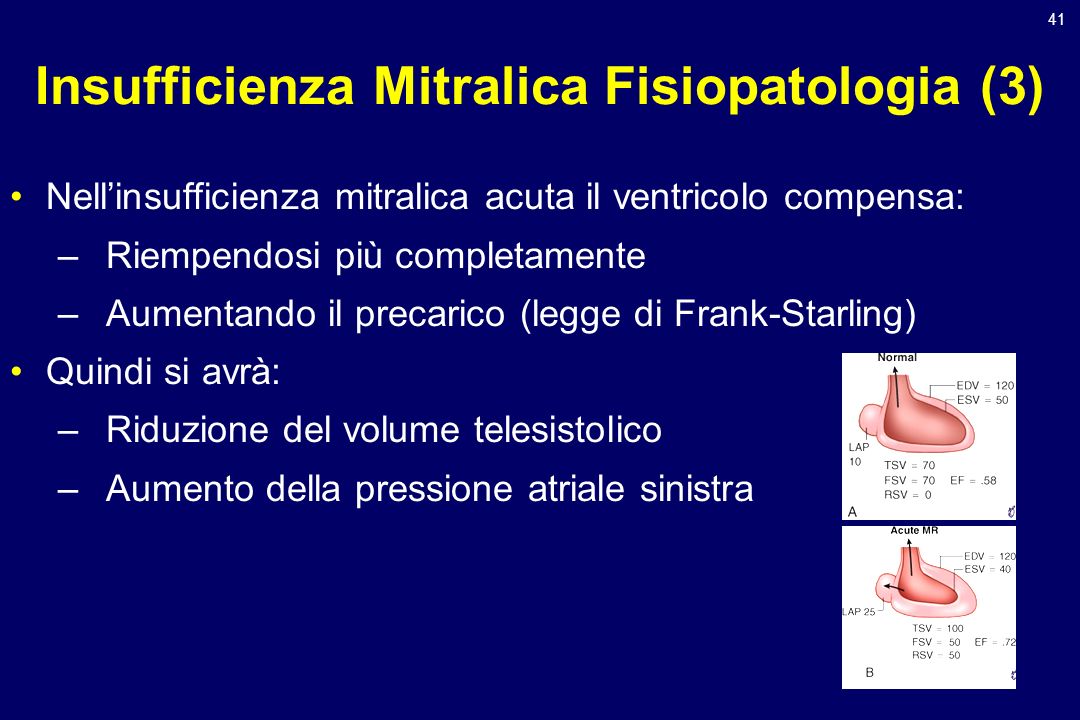 Insufficienza Mitralica Fisiopatologia (3)