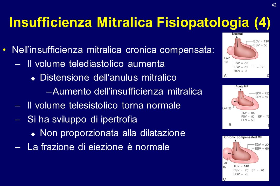 Insufficienza Mitralica Fisiopatologia (4)