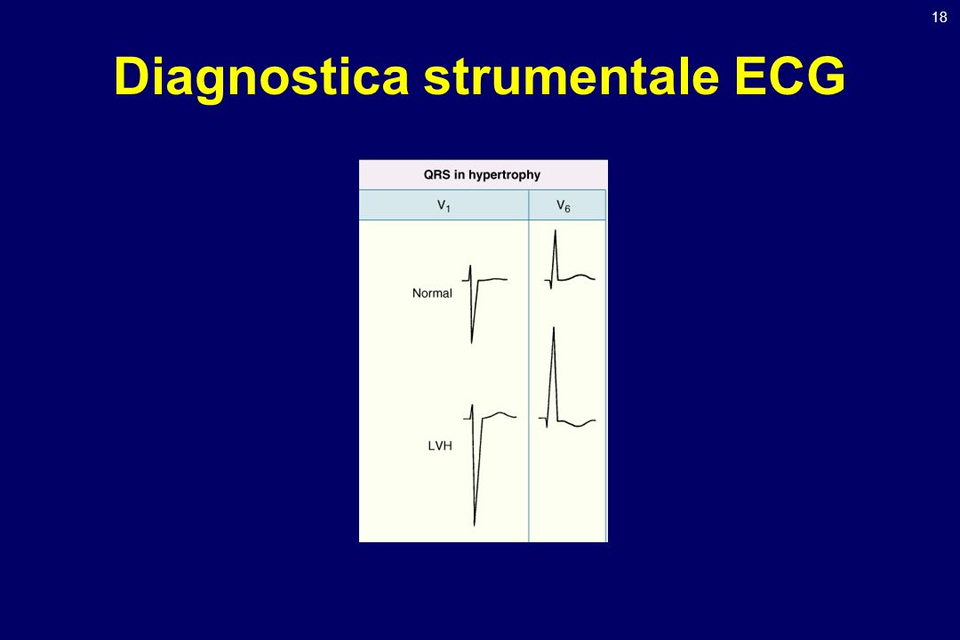 Diagnostica strumentale ECG