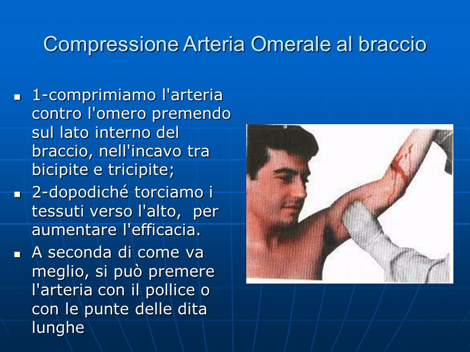 Compressione Arteria Omerale al braccio