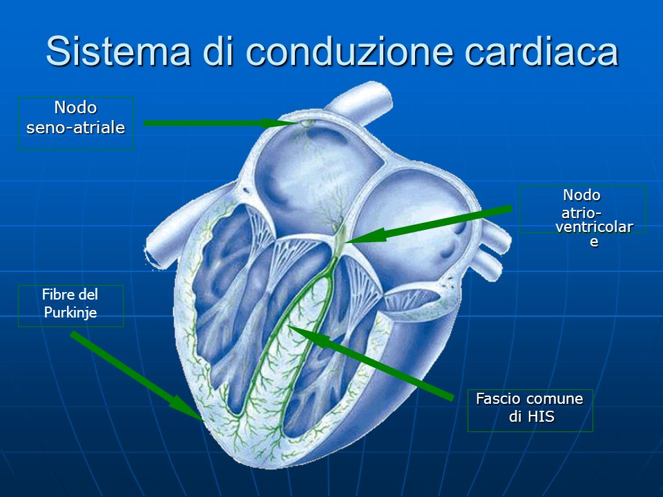 Sistema di conduzione cardiaca
