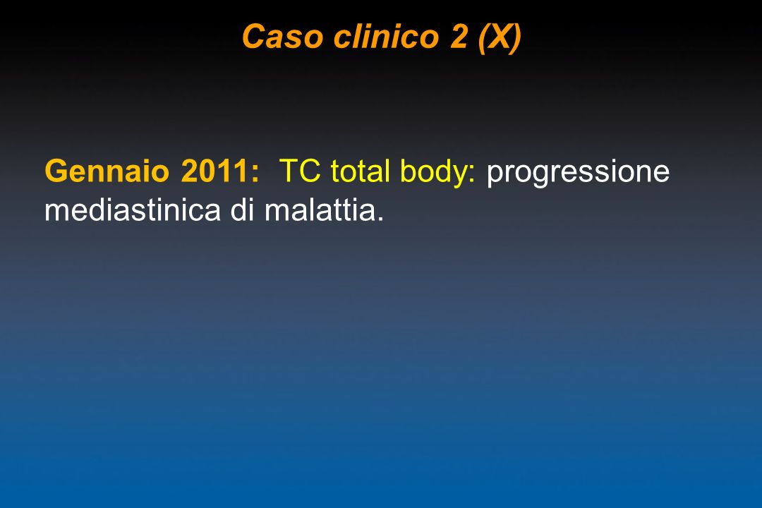 Caso clinico 2 (X) Gennaio 2011: TC total body: progressione mediastinica di malattia.