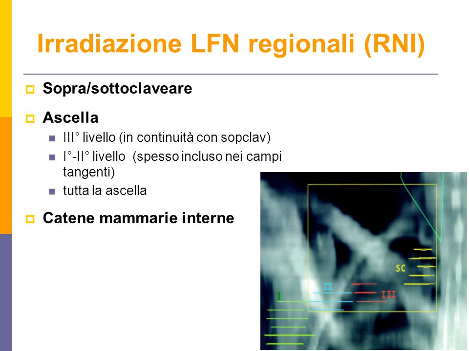 Irradiazione LFN regionali (RNI)