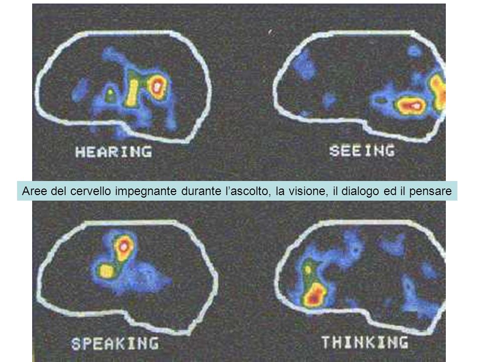 Aree del cervello impegnante durante l’ascolto, la visione, il dialogo ed il pensare