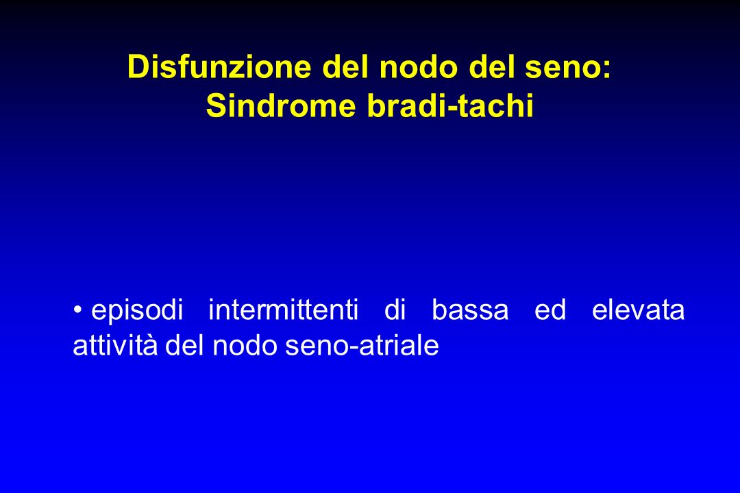 Disfunzione del nodo del seno: Sindrome bradi-tachi