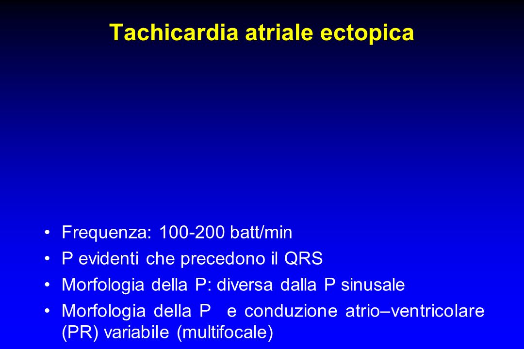 Tachicardia atriale ectopica