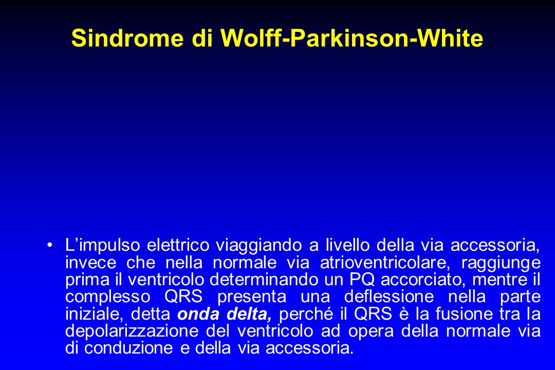 Sindrome di Wolff-Parkinson-White
