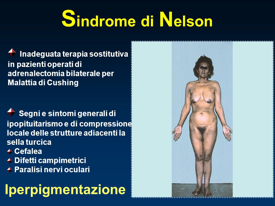 Sindrome di Nelson Iperpigmentazione