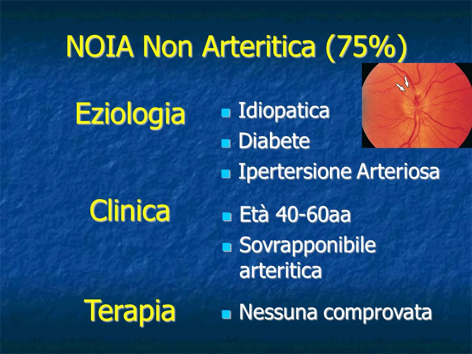 NOIA Non Arteritica (75%)