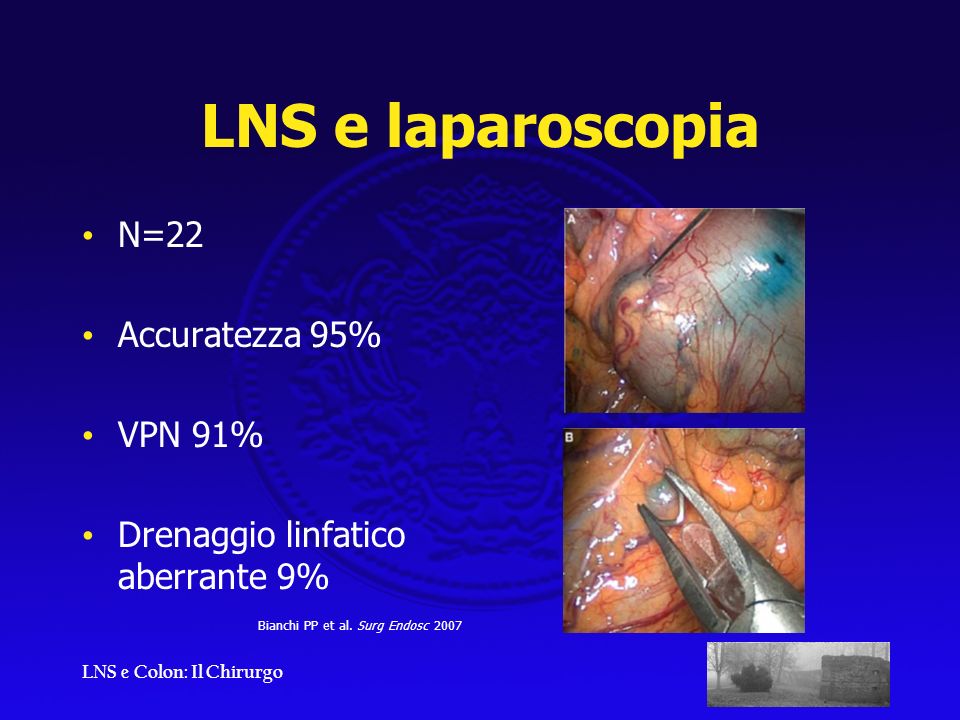 LNS e laparoscopia N=22 Accuratezza 95% VPN 91%