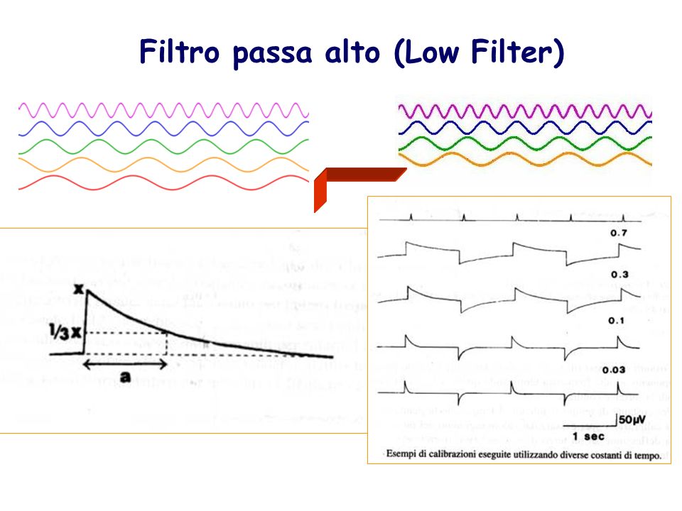 Filtro passa alto (Low Filter)