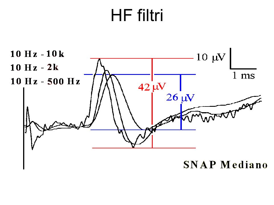 HF filtri