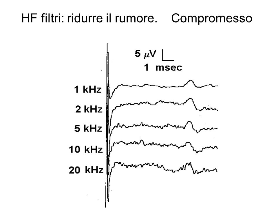 HF filtri: ridurre il rumore. Compromesso