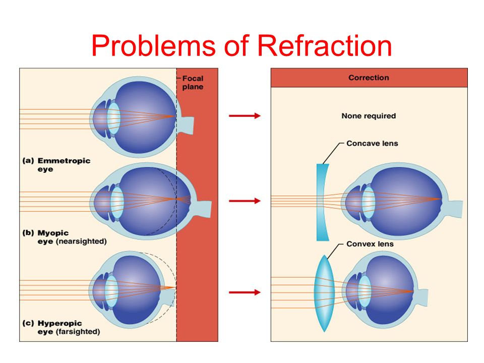 Problems of Refraction