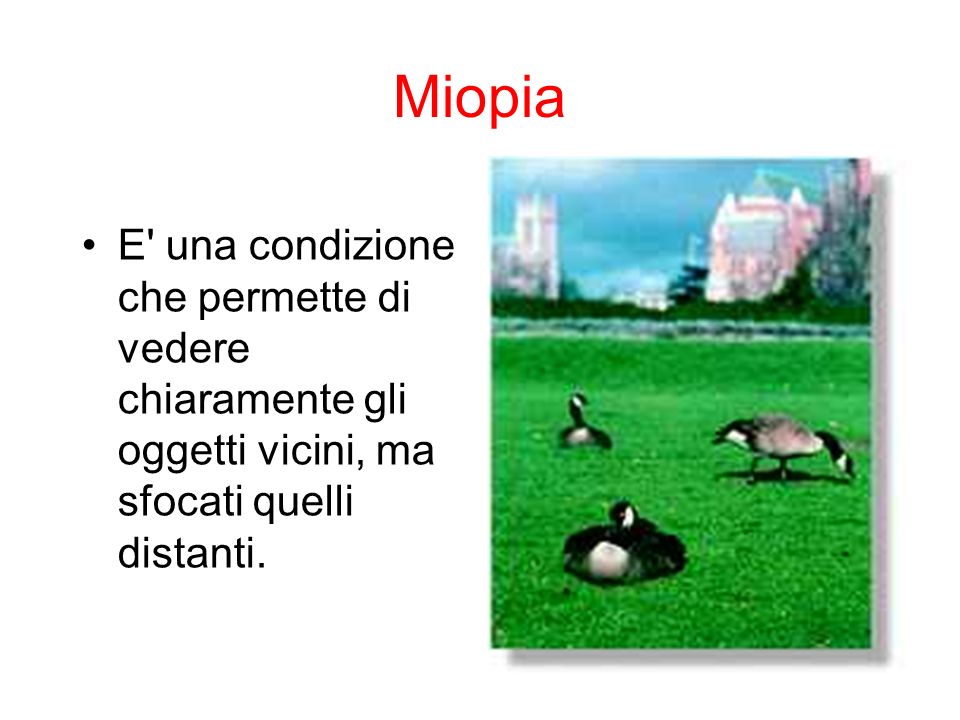 Miopia E una condizione che permette di vedere chiaramente gli oggetti vicini, ma sfocati quelli distanti.