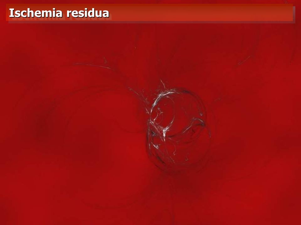 Ischemia residua VEDI FLE EXCEL SUL PC fisso