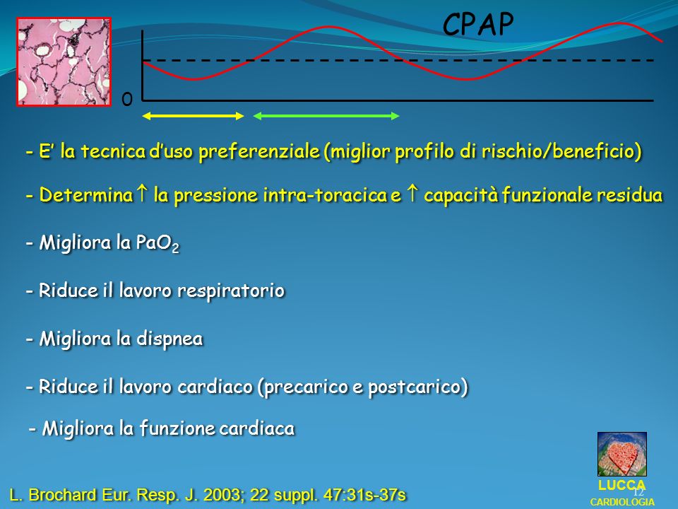 CPAP - E’ la tecnica d’uso preferenziale (miglior profilo di rischio/beneficio)