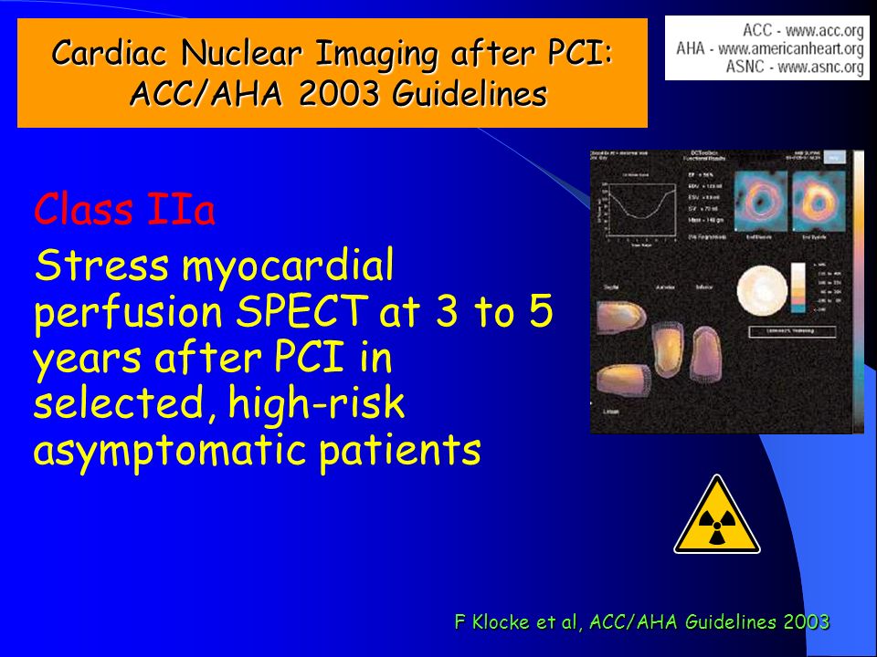 Cardiac Nuclear Imaging after PCI: ACC/AHA 2003 Guidelines