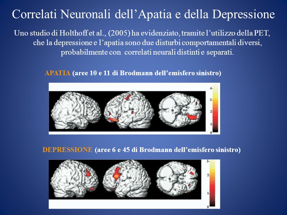 Correlati Neuronali dell’Apatia e della Depressione
