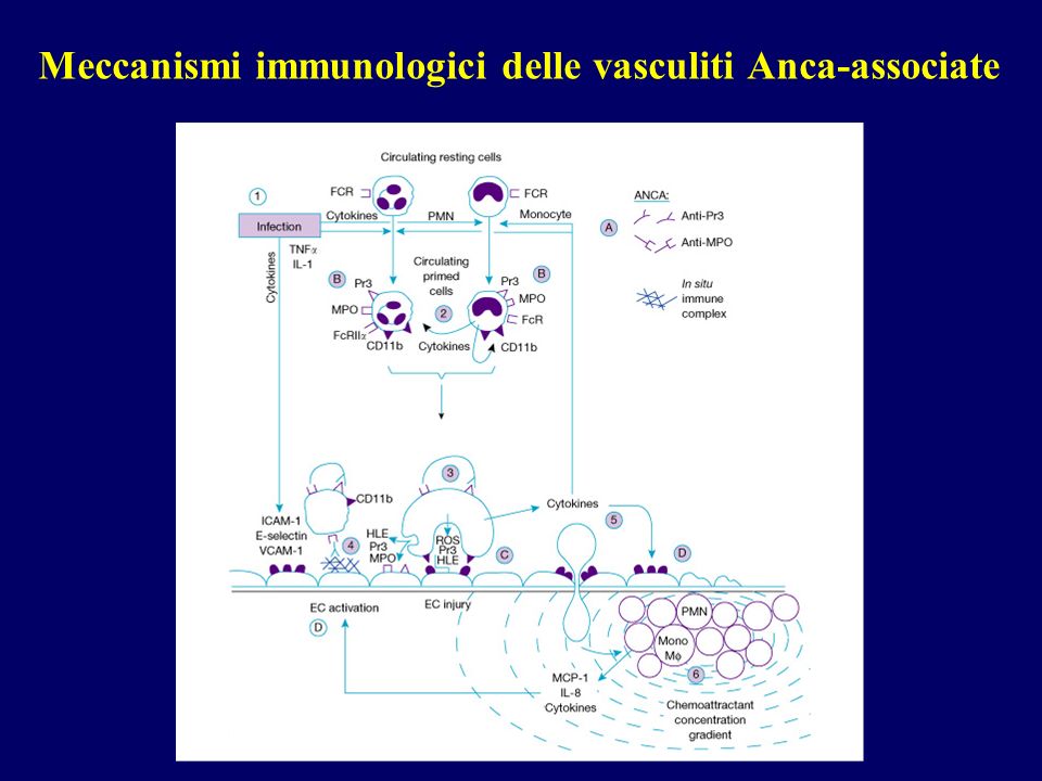 Meccanismi immunologici delle vasculiti Anca-associate