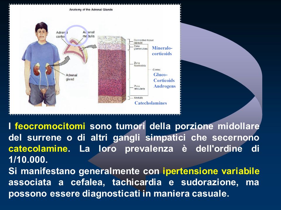 I feocromocitomi sono tumori della porzione midollare del surrene o di altri gangli simpatici che secernono catecolamine. La loro prevalenza è dell ordine di 1/