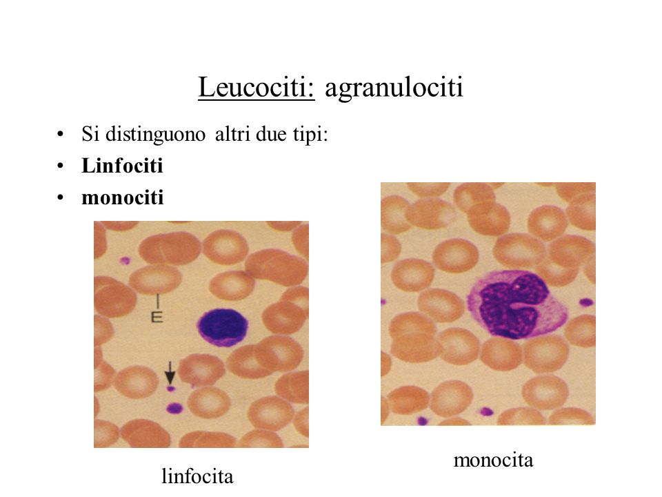 Leucociti: agranulociti