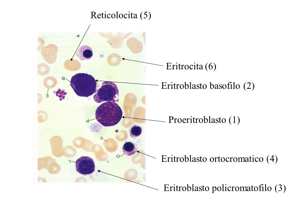 Reticolocita (5) Eritrocita (6) Eritroblasto basofilo (2) Proeritroblasto (1) Eritroblasto ortocromatico (4)