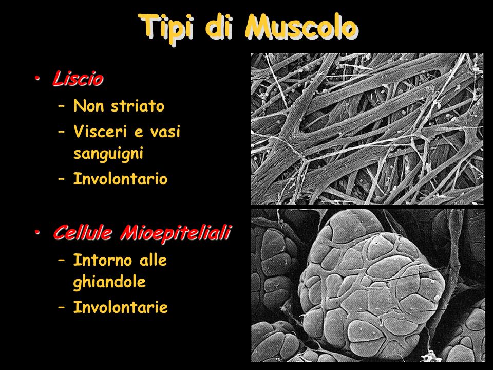 Tipi di Muscolo Liscio Cellule Mioepiteliali Non striato
