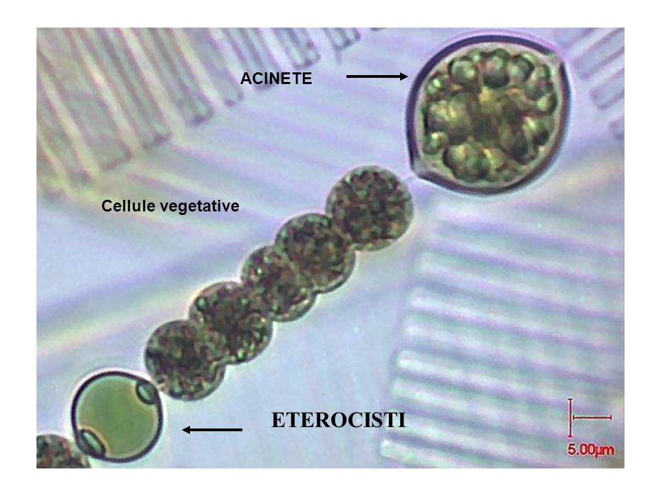 ACINETE Cellule vegetative ETEROCISTI