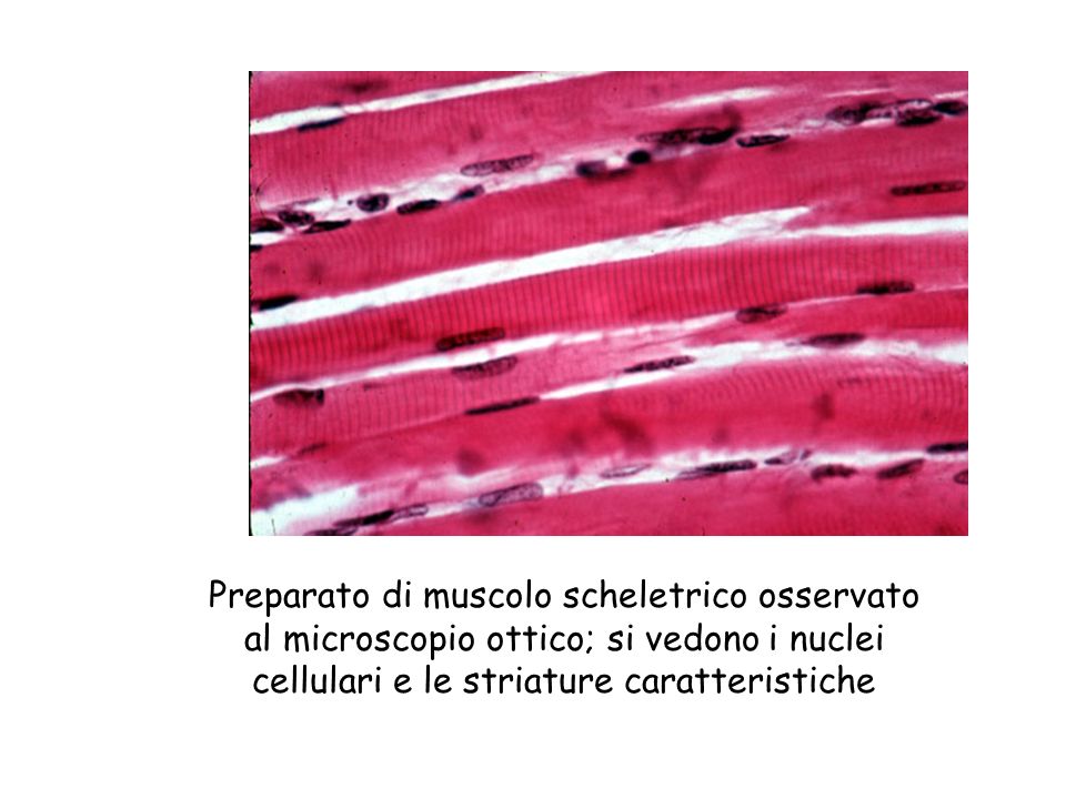 Preparato di muscolo scheletrico osservato al microscopio ottico; si vedono i nuclei cellulari e le striature caratteristiche