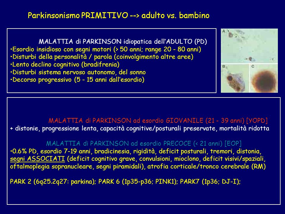 Parkinsonismo PRIMITIVO --> adulto vs. bambino