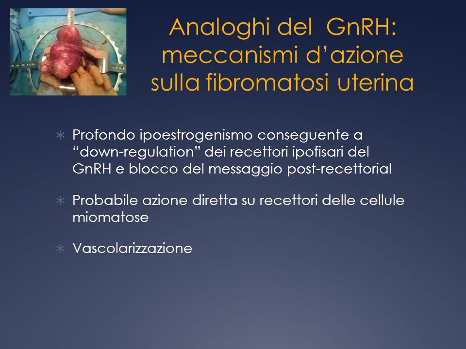 Analoghi del GnRH: meccanismi d’azione sulla fibromatosi uterina