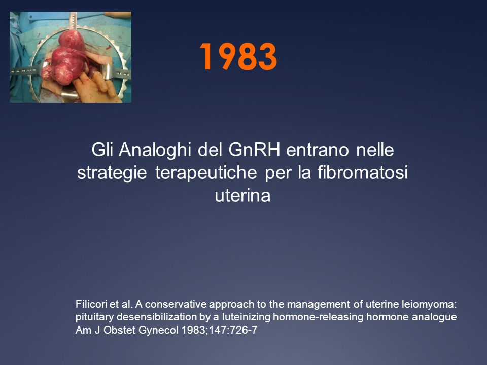 1983 Gli Analoghi del GnRH entrano nelle strategie terapeutiche per la fibromatosi uterina.