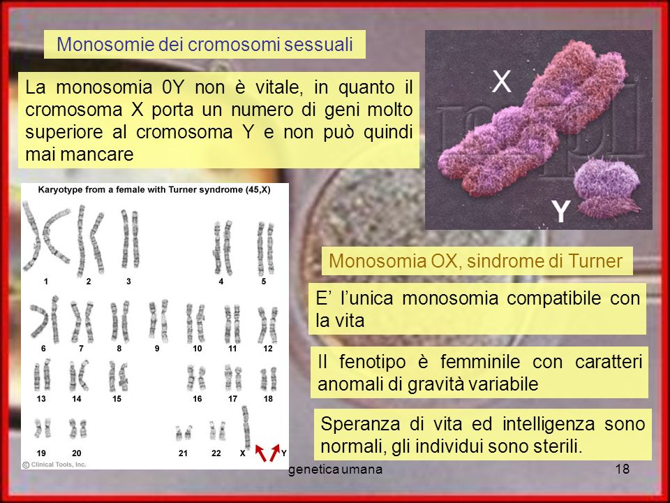 Monosomie dei cromosomi sessuali