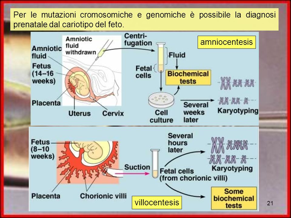 Per le mutazioni cromosomiche e genomiche è possibile la diagnosi prenatale dal cariotipo del feto.