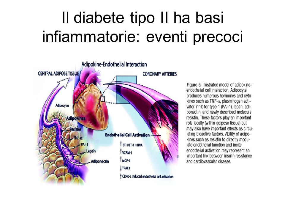 Il diabete tipo II ha basi infiammatorie: eventi precoci