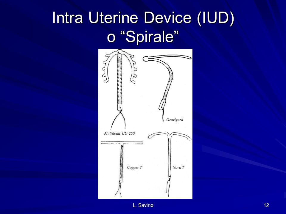 Intra Uterine Device (IUD) o Spirale